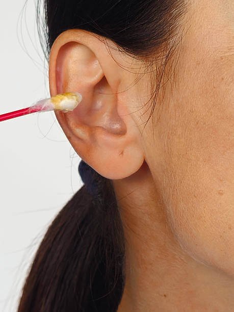 Ear wax microsuction treatment