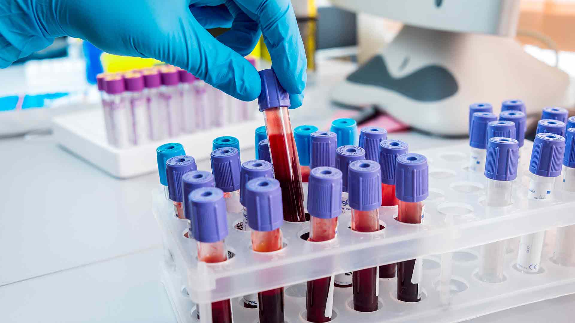 blood-test
