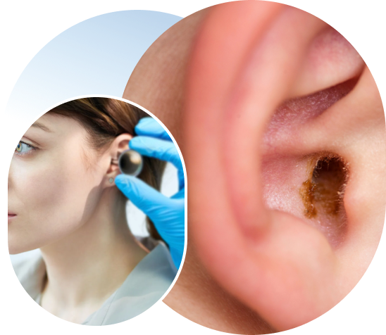 What is Earwax?​