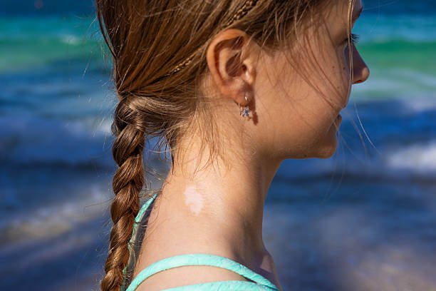 Children's Ear Piercing in Epping